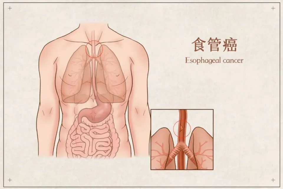 腌菜虽美味，但隐藏4大健康隐患，增加癌症风险，建议少吃  第4张