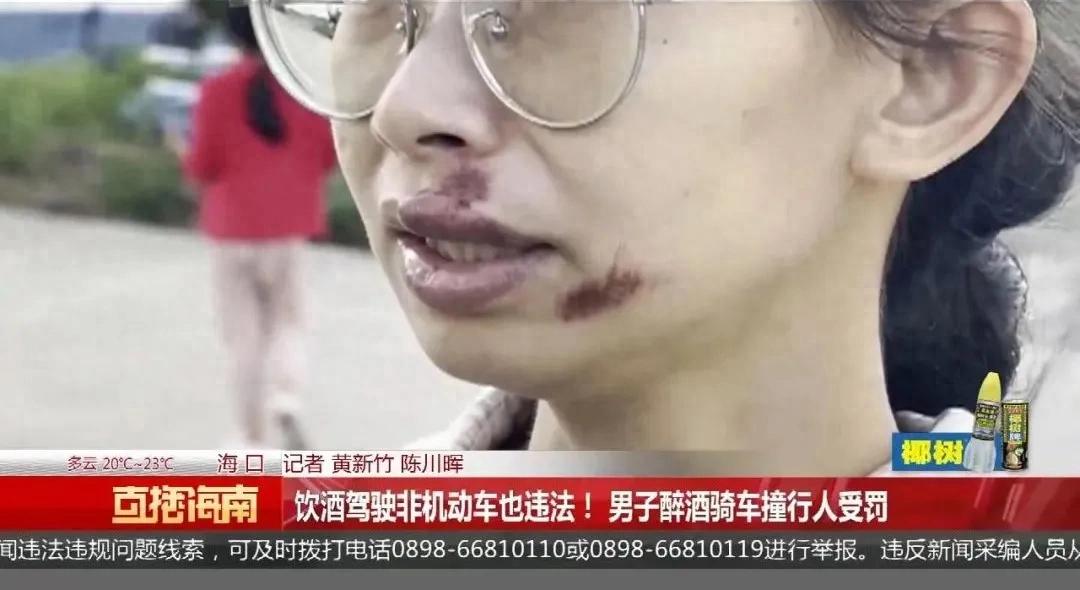 酒后骑行电动自行车算酒驾？海口王某醉驾撞伤路人引发关注  第1张