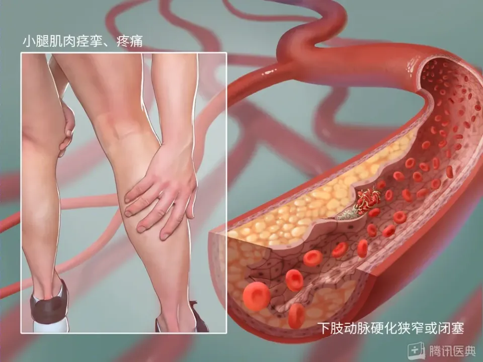 冬天手脚冰凉是身体保护机制？女生为何更易受影响？  第7张