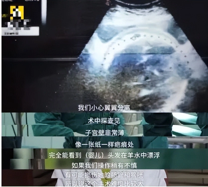 5年剖4胎终得女儿，千万网红彩虹夫妇官宣4胎出生，母婴平安引热议  第8张