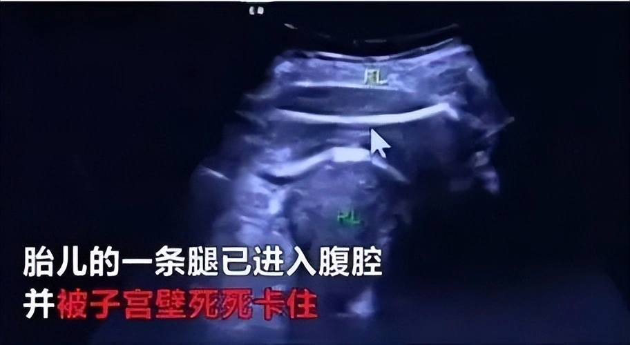 5年剖4胎终得女儿，千万网红彩虹夫妇官宣4胎出生，母婴平安引热议  第10张