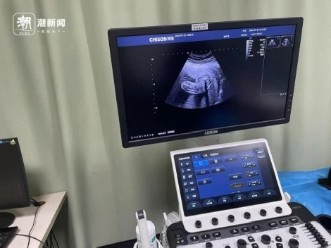 超声诊断设备销售灰色链条调查：官方调查为何未能及时回应公众关切？  第1张