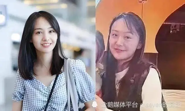 郑爽近照曝光：头发稀疏脸肿，网友热议昔日当红小花现状  第1张