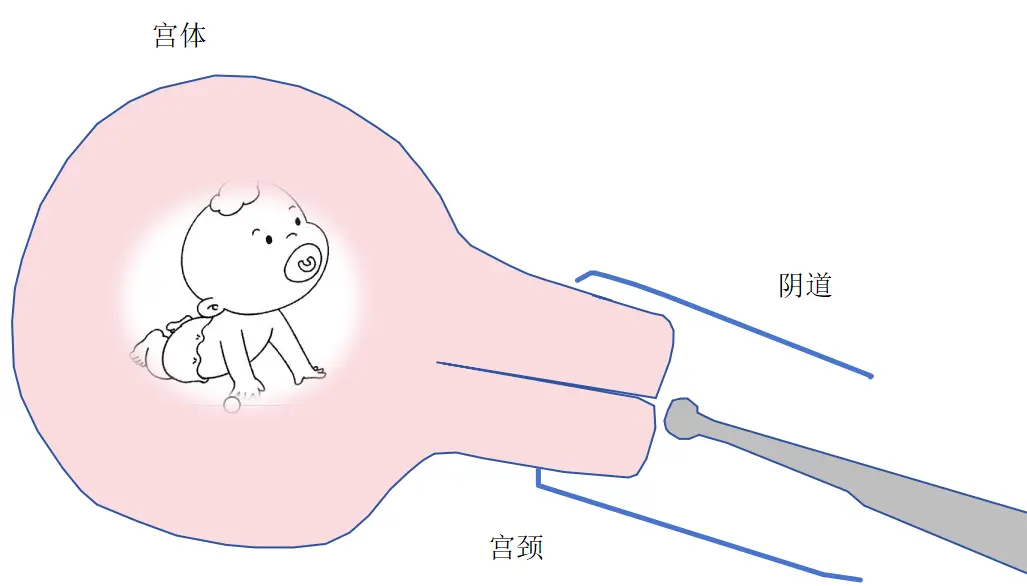 怀孕期间做阴超是否安全？专家解析阴超对胎儿的影响  第1张