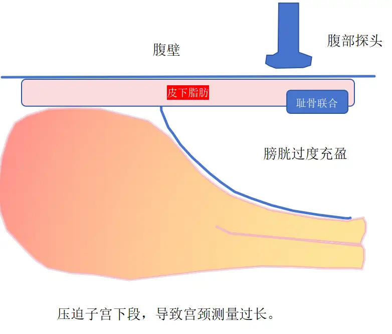 怀孕期间做阴超是否安全？专家解析阴超对胎儿的影响  第2张