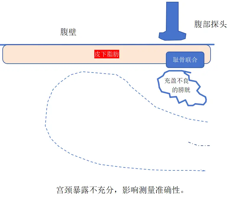 怀孕期间做阴超是否安全？专家解析阴超对胎儿的影响  第3张