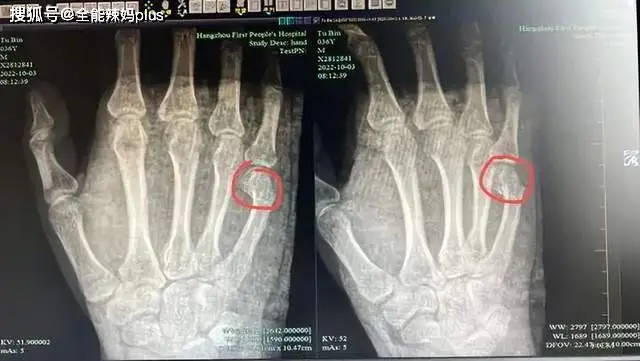 现代家长辅导作业的痛点：情绪失控与焦虑的根源  第2张