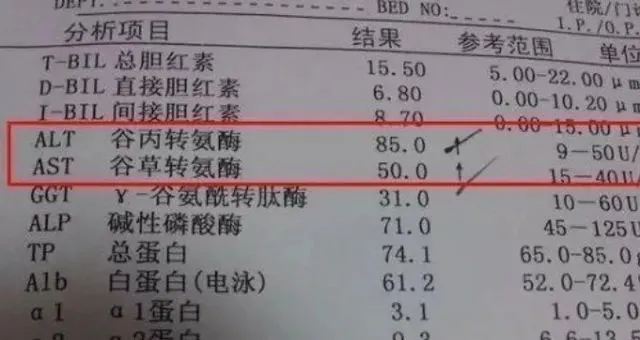 深入了解肝功能检查中的关键指标：转氨酶、胆红素和白蛋白